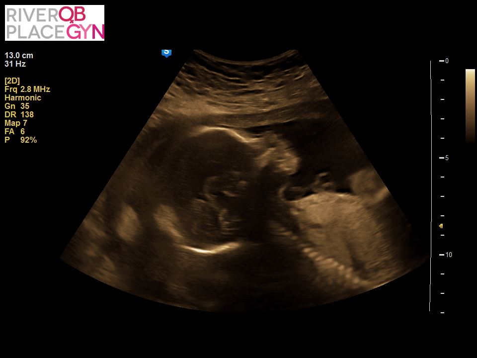 One Year Difference – A reflection